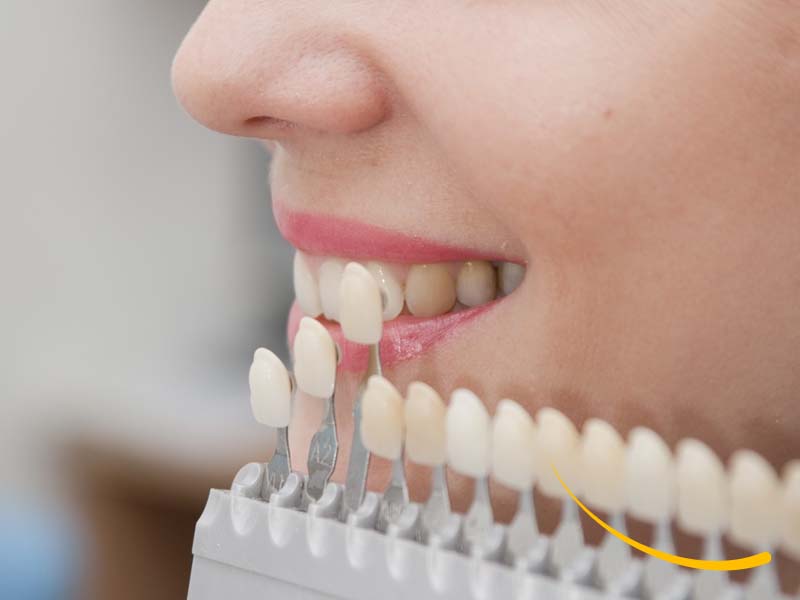 belledent-odontologia-especializada-dental-dentista-miraflores-lima-peru-especialidades-03002-rehabilitacion-oral