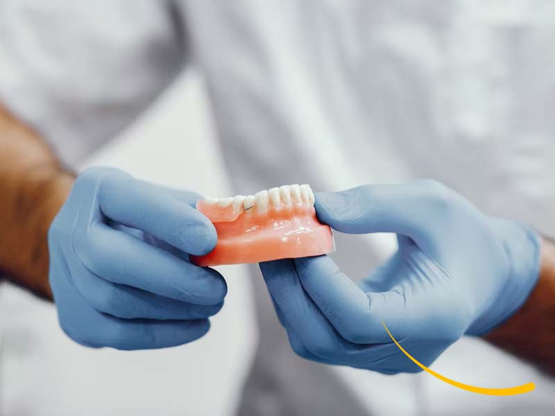 belledent-odontologia-especializada-dental-dentista-miraflores-lima-peru-especialidades-03006-implantes